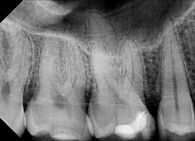 Snimak zuba banjaluka 2